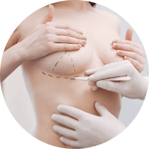 Breast Surgery